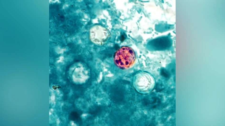 Michigan Confirms Two Deaths Linked to Cyclospora Outbreak